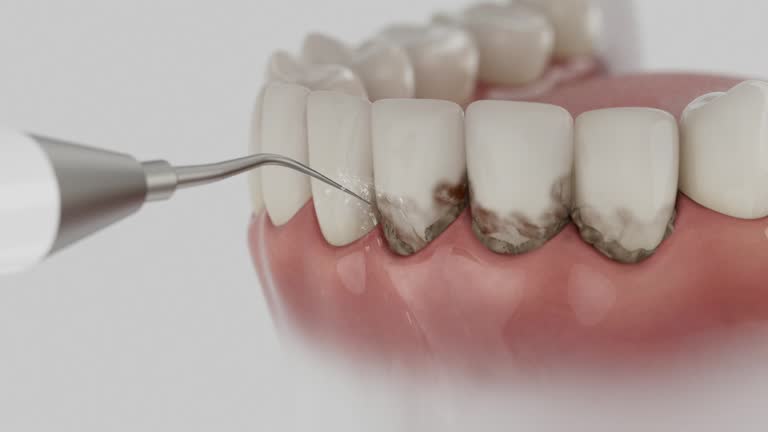 Reliable Dental Implants contractor in Robert Lee, TX by Smile Center Dentistry